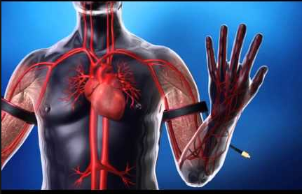 روش کاتسو یا انسداد جریان خون؟