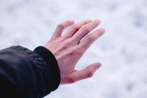 هایپوترمی
