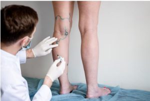 بازگشت DVT _ بازگشت دی وی تی