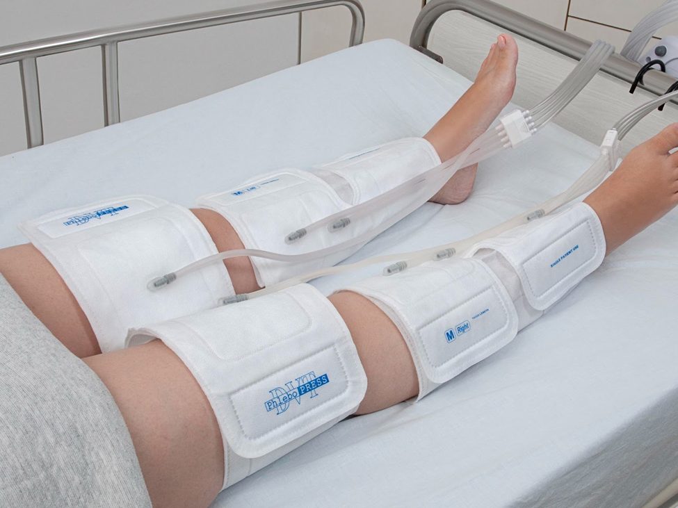 پیشگیری از DVT