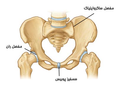 در رفتگی لگن 