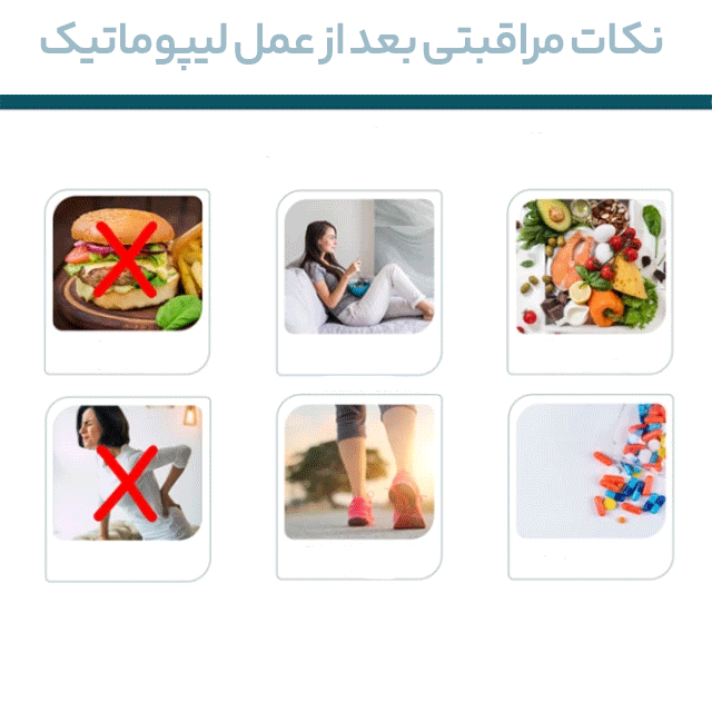 نکات مراقبتی بعد از عمل لیپوماتیک یا پیکرتراشی
