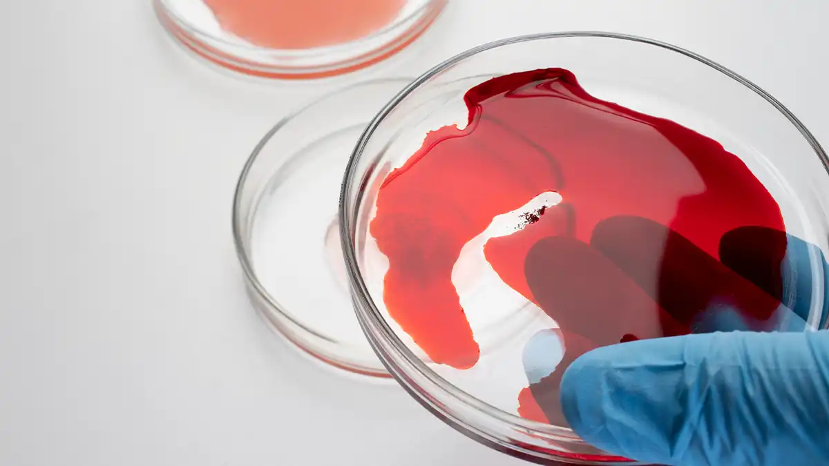 روش های پیشگیری از لخته خون در پا