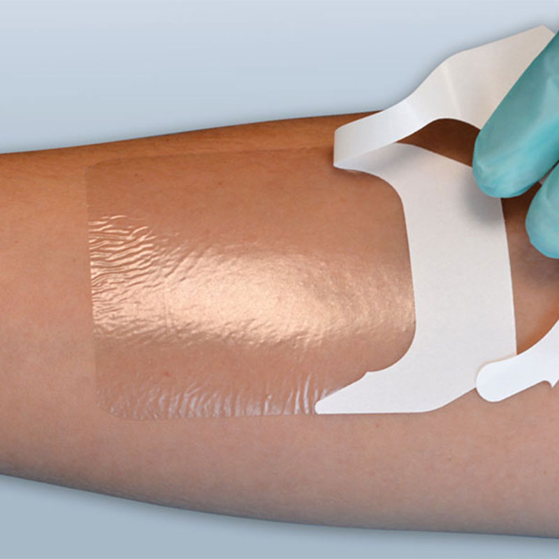 10. پانسمان‌های فیلم شفاف (Transparent Film Dressings):