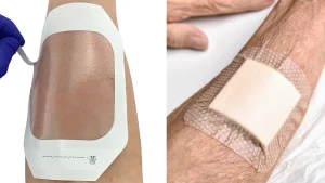 طرز استفاده از چسب کامفیل برای زخم بستر (3)