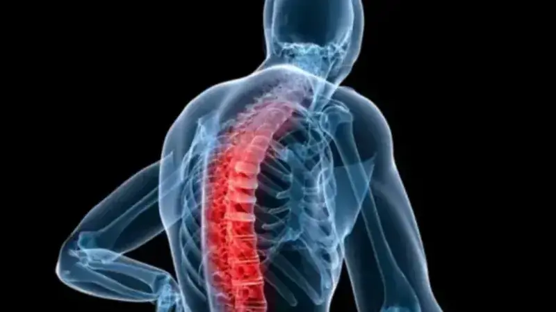 آسیب ناقص نخاعی و طبقه‌بندی آن