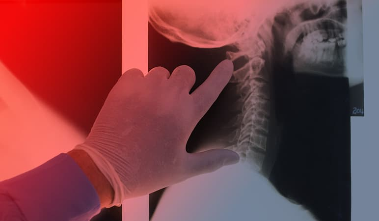 نخاع چیست و چه نقشی دارد؟