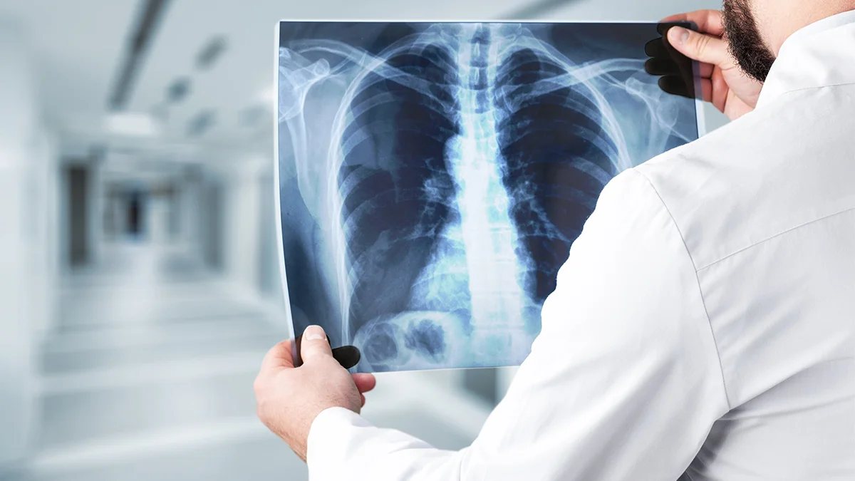 تشخیص پارگی روتاتور کاف در شانه