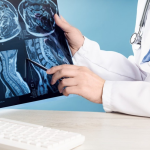 تاثیر آسیب نخاعی بر مغز