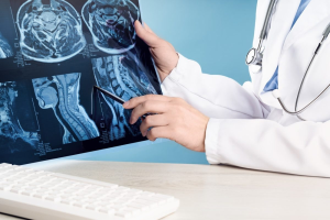 تاثیر آسیب نخاعی بر مغز