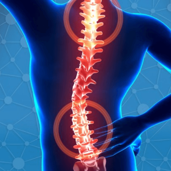 جراحی اسکولیوز (Scoliosis Surgery)