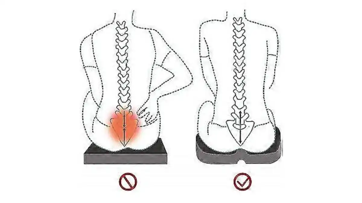 تاثیر تشک مواج ویلچر بر کاهش فشار استخوان دنبالچه و زخم