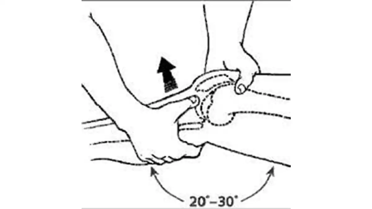 تست لاچمن (Lachman Test)