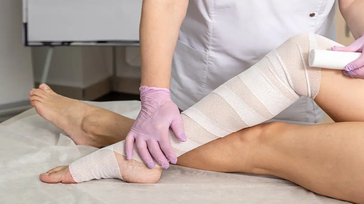 بانداژ فشاری برای درمان تورم غدد لنفاوی