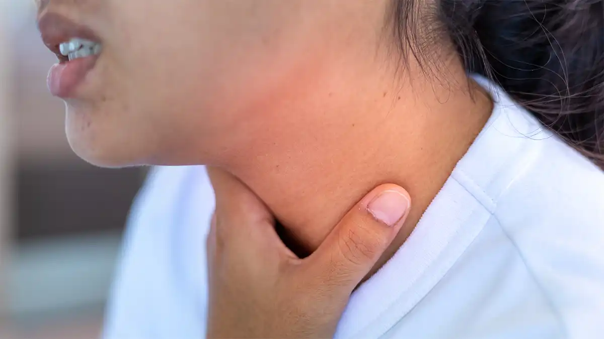 4 روش درمان تورم غدد لنفاوی