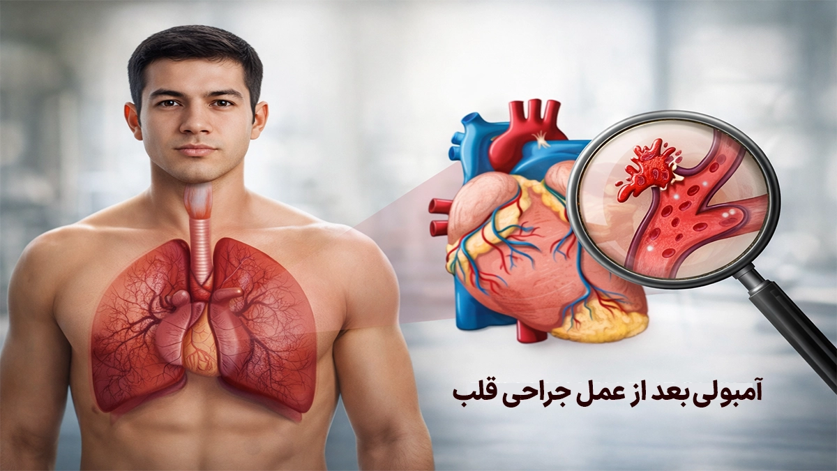 آمبولی بعد از جراحی قلب