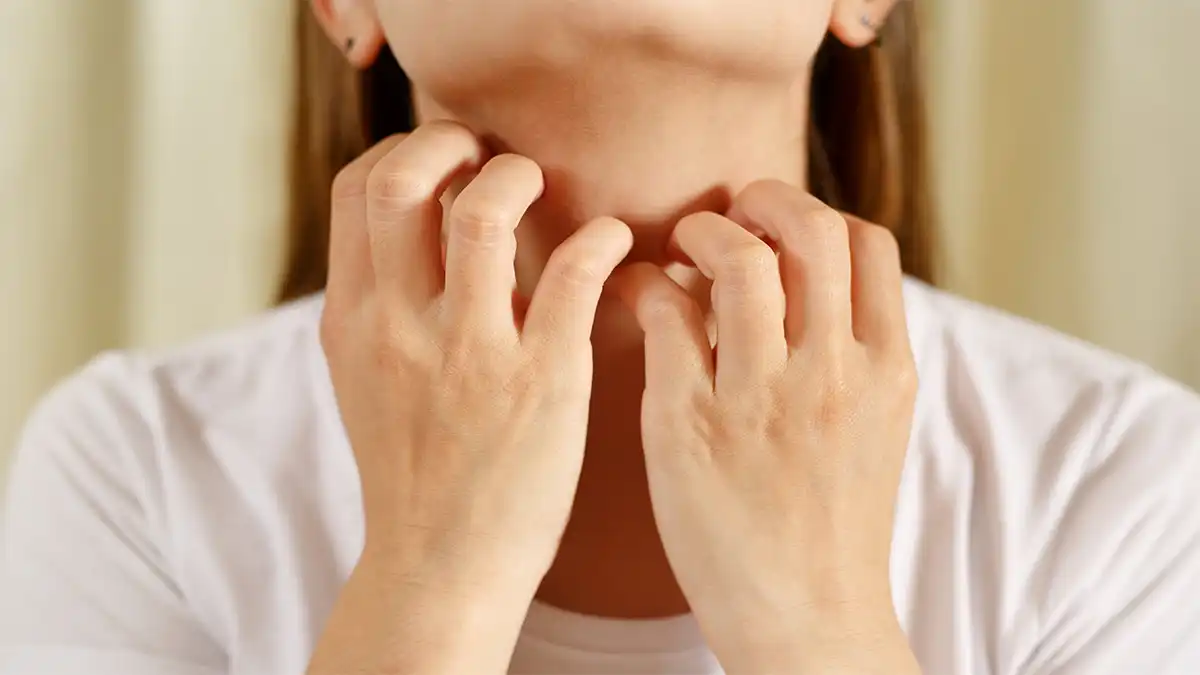 تورم غدد لنفاوی چیست