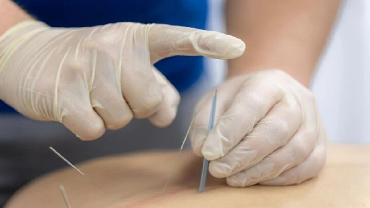طب سوزنی ضایعه نخاعی