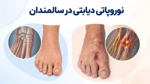 نوروپاتی دیابتی در سالمندان+علائم ، تشخیص،عوارض