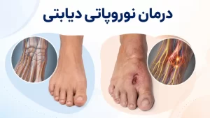 نوروپاتی دیابتی در سالمندان+علائم ، تشخیص،عوارض