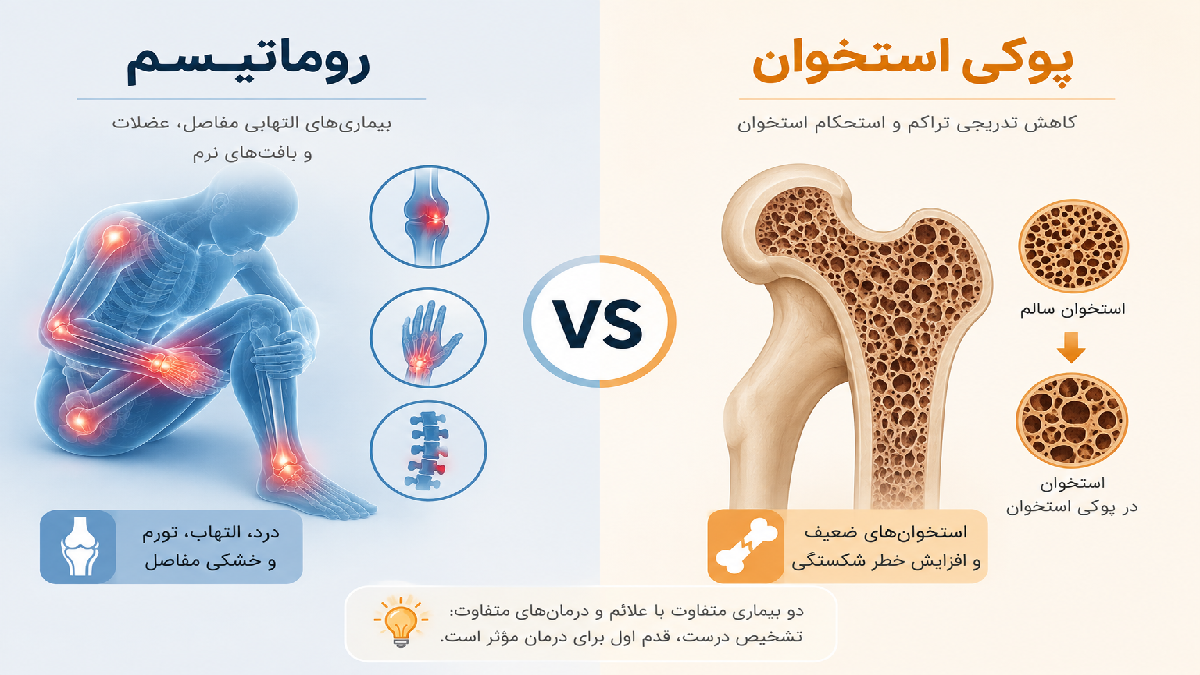 روماتیسم مفصلی و پوکی استخوان