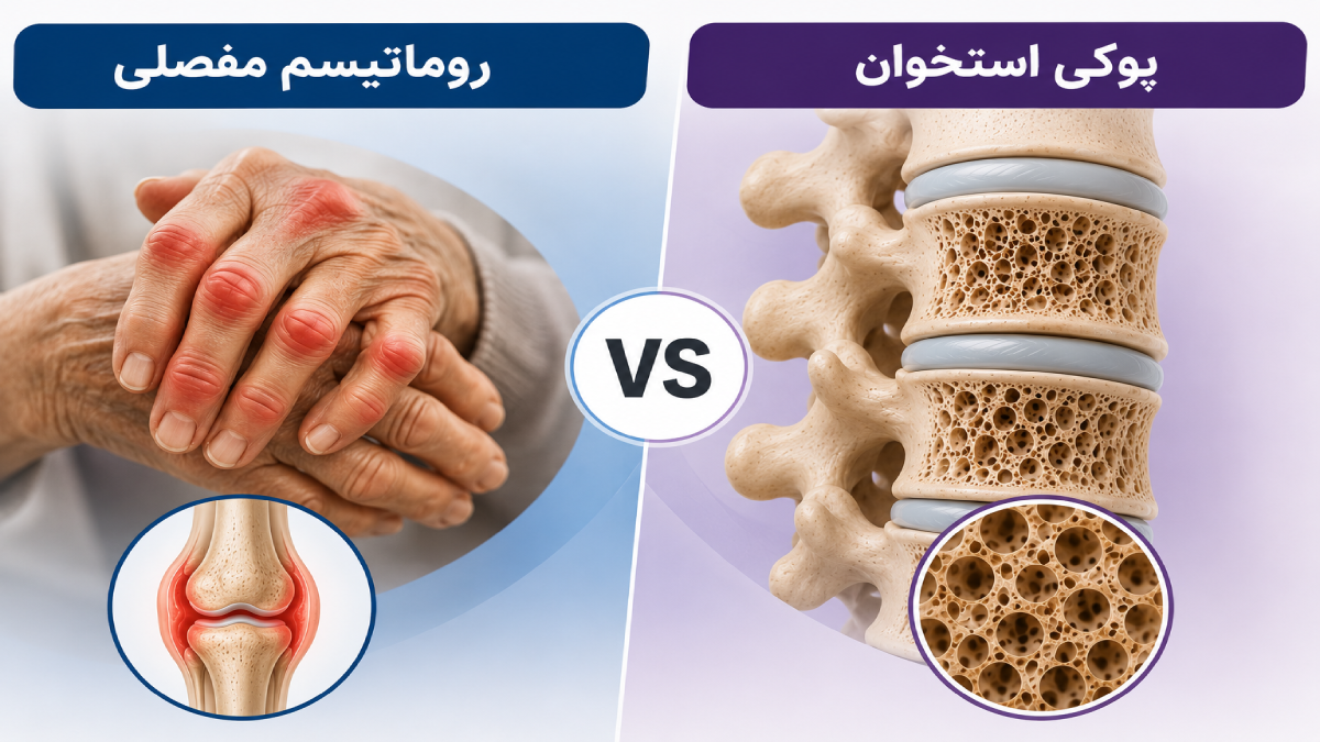 فرق بین روماتیسم و پوکی استخوان