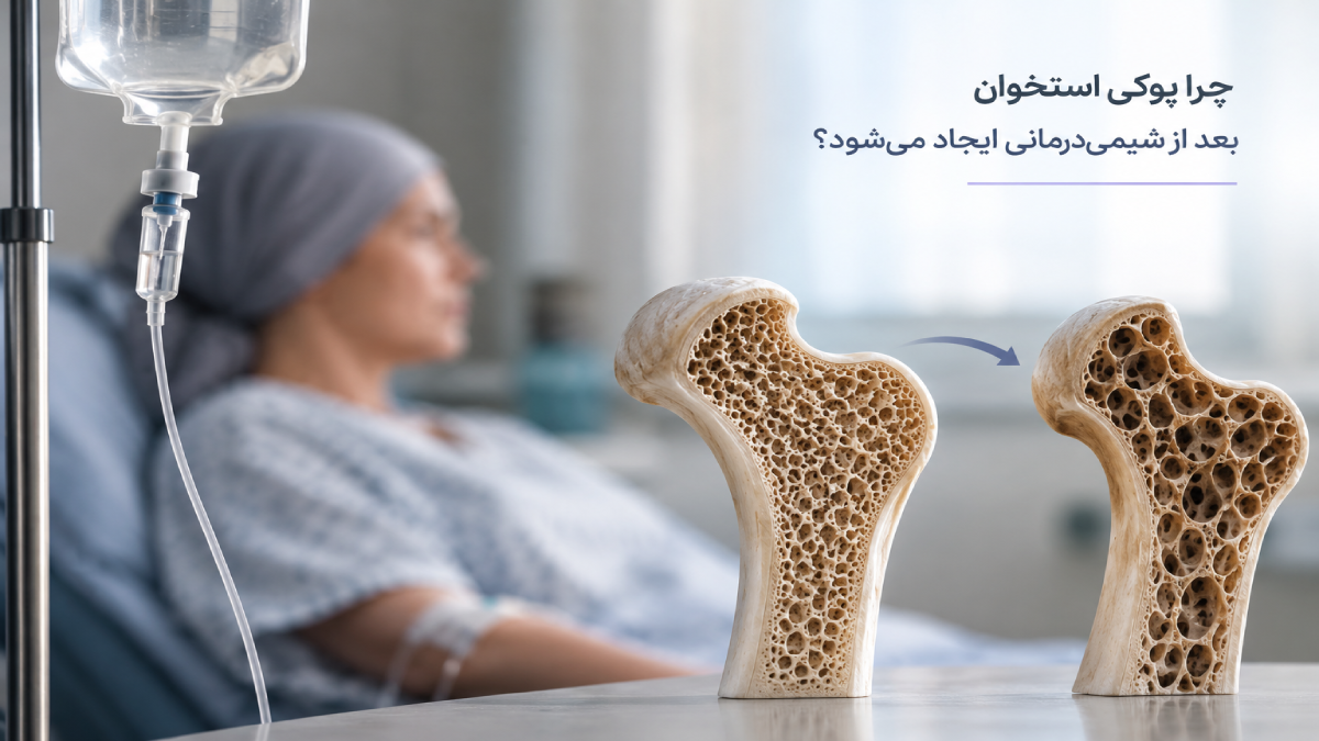 چرا پوکی استخوان بعد از شیمی درمانی ایجاد می شود ؟