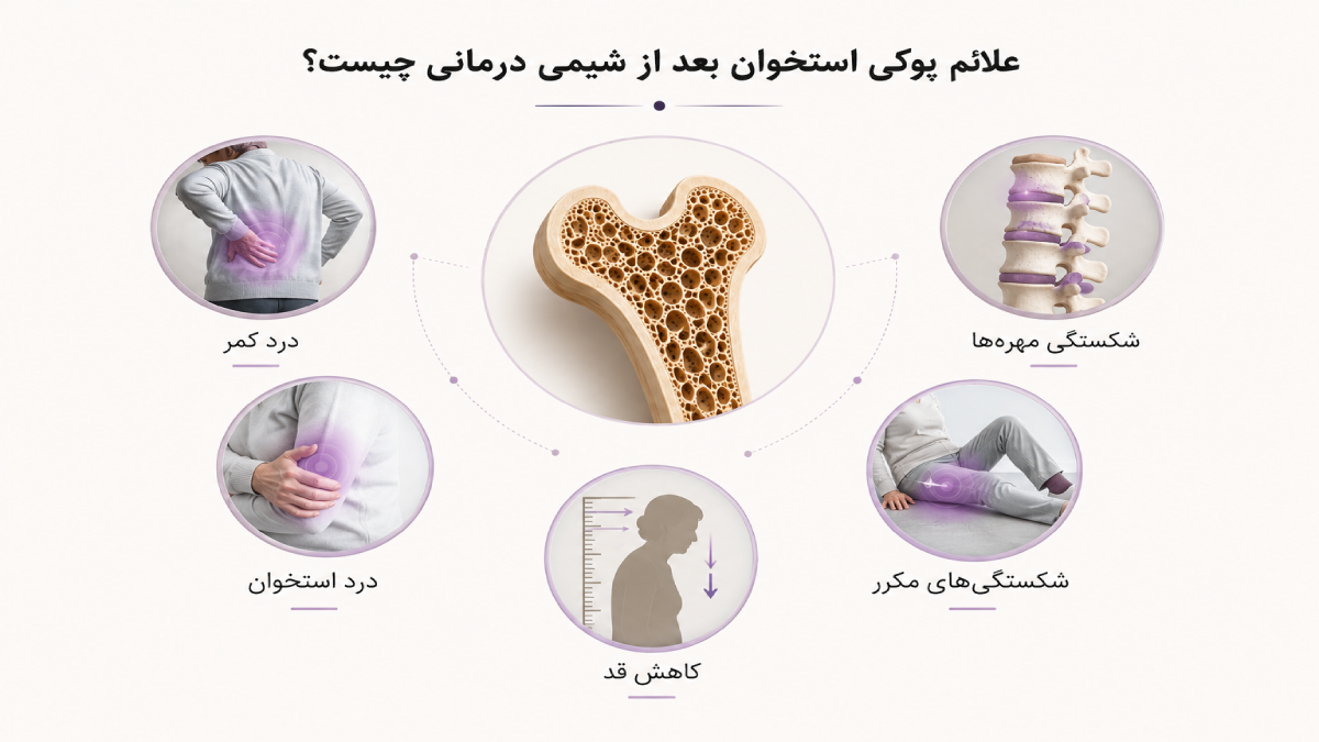 علائم پوکی استخوان بعد از شیمی درمانی 