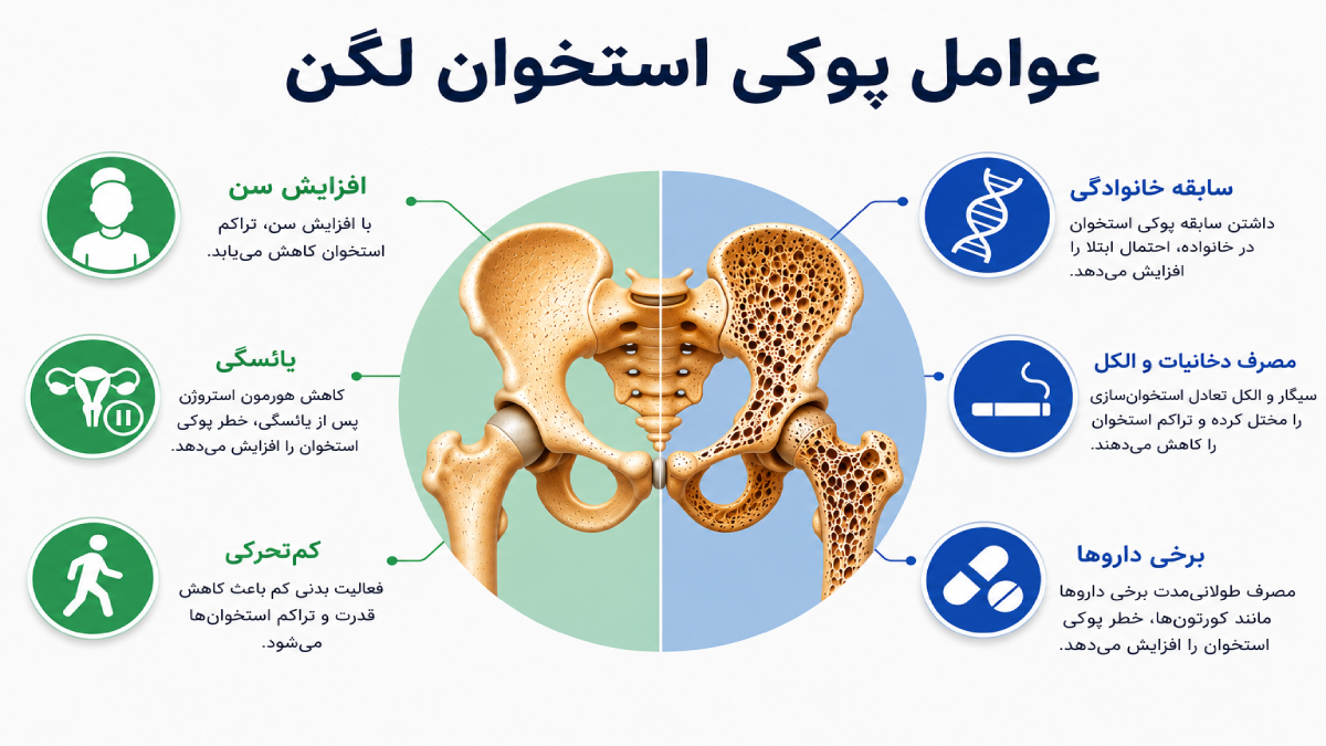 عوامل پوکی استخوان لگن 