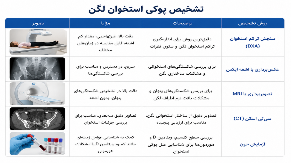 تشخیص پوکی استخوان لگن