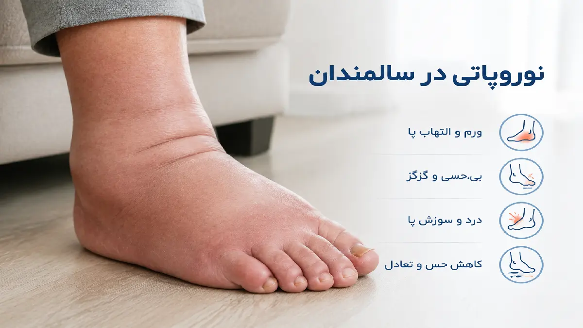 نوروپاتی در سالمندان چیست ؟علائم،تشخیص و درمان