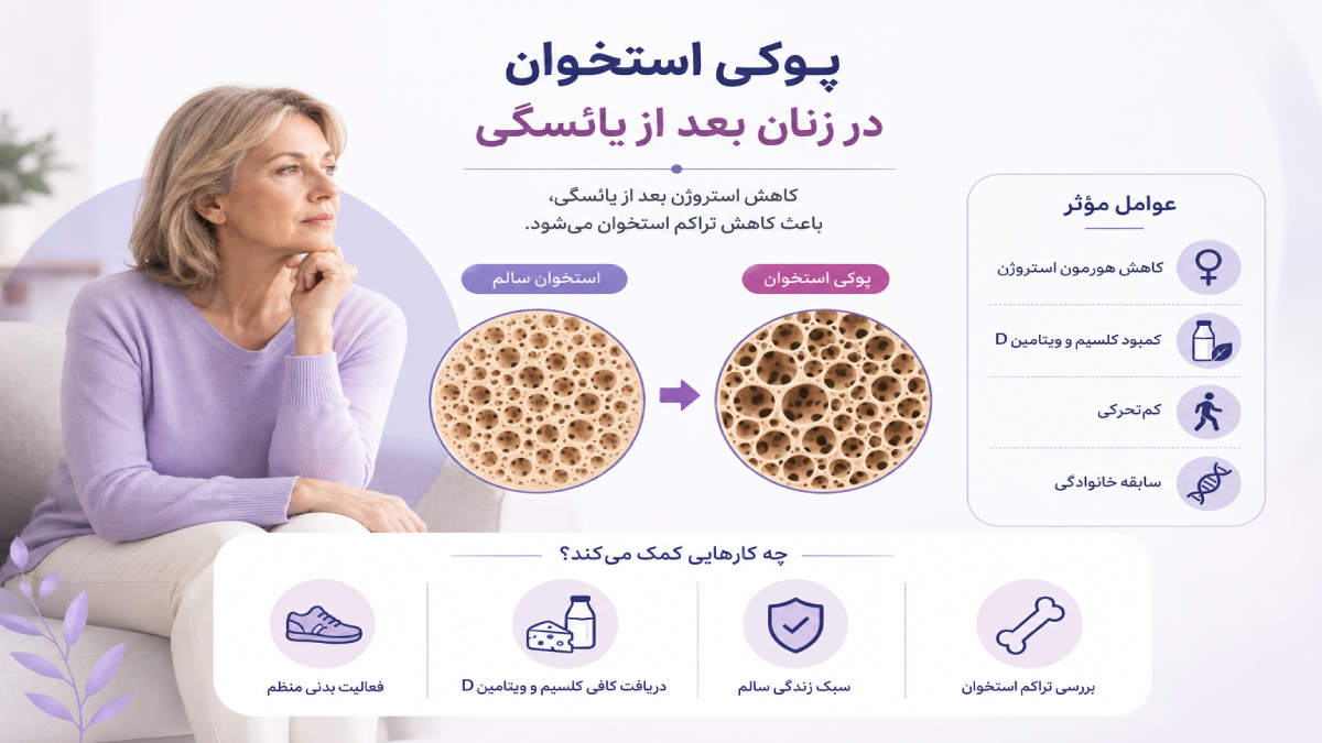 پوکی استخوان در زنان یائسه